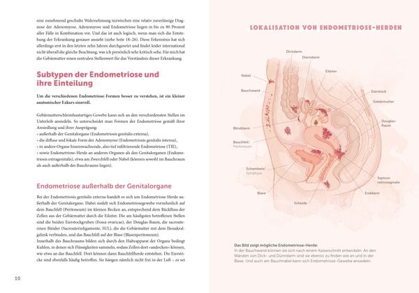 "Endometriose - Die unterschätzte Krankheit" Prof. Dr. Sylvia Mechsner