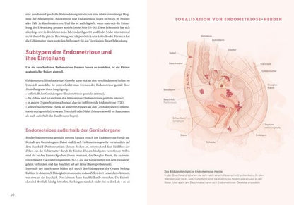 "Endometriose - Die unterschätzte Krankheit" Prof. Dr. Sylvia Mechsner